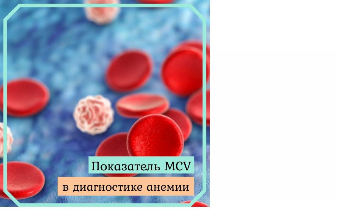 Показатель MCV в диагностике анемии